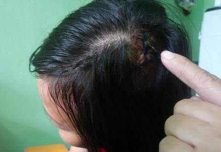 Giam doc benh vien noi ve vu nu tai xe taxi bi bao ve danh vo dau hinh anh