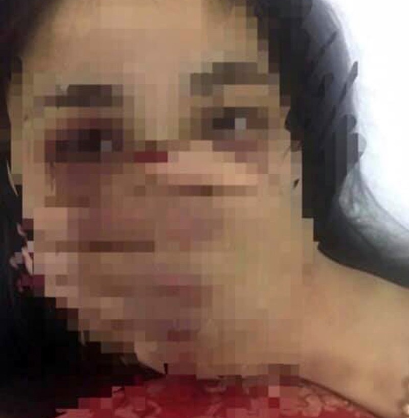 Bác sĩ đánh nữ sinh nhập viện ảnh 1 Bac si danh nu sinh nhap vien anh 1