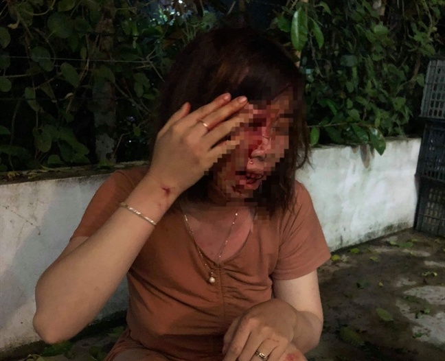 Hanh hung phu nu co thai anh 1