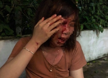 Nguoi me mang thai 4 thang bi hang xom danh nhap vien hinh anh