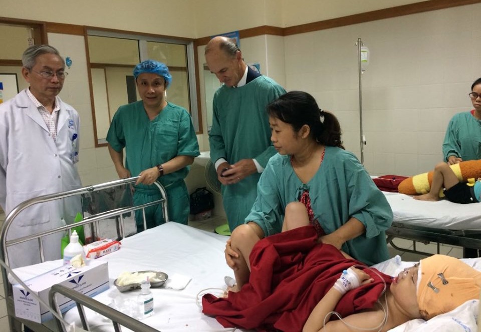 Cô bé bị dị tật hiếm gặp ảnh 1 Co be bi di tat hiem gap anh 1