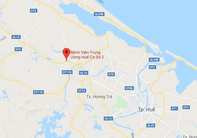 Thai nhi bị thắt nút dây rốn ảnh 2 Thai nhi bi that nut day ron anh 2