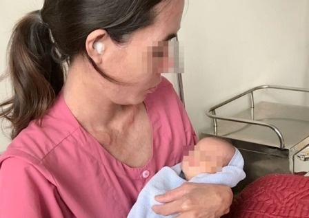 Phau thuat cuu thai nhi bi that nut day ron hiem gap hinh anh