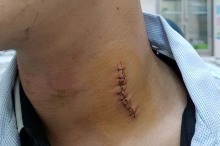 Manh kim loai dai 1 cm gam vao co tho sua oto hinh anh