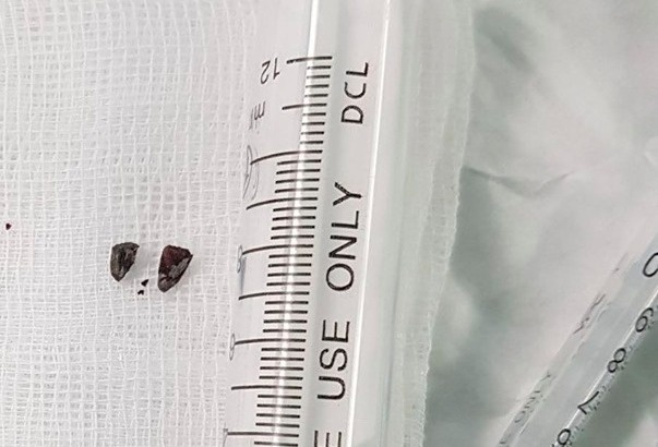 Manh phao ban vao dau anh 1