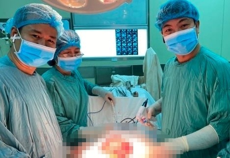 Lay khoi u 9 kg trong bung nguoi phu nu 68 tuoi hinh anh