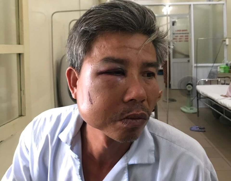 Chủ quán cà phê đánh người ảnh 1 Chu quan ca phe danh nguoi anh 1