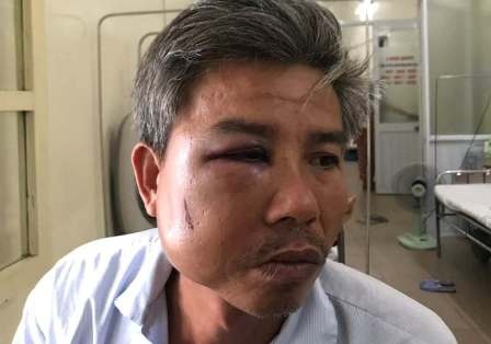 Chu quan ca phe dap vao mat nhan vien cay xanh bi khoi to hinh anh