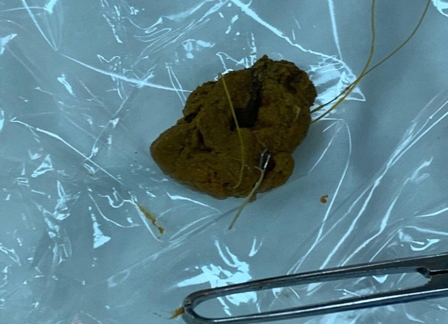 Moc cau nam trong ruot anh 2