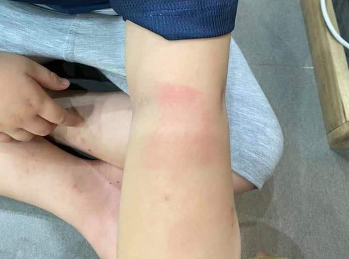 Ky luat co giao anh 2