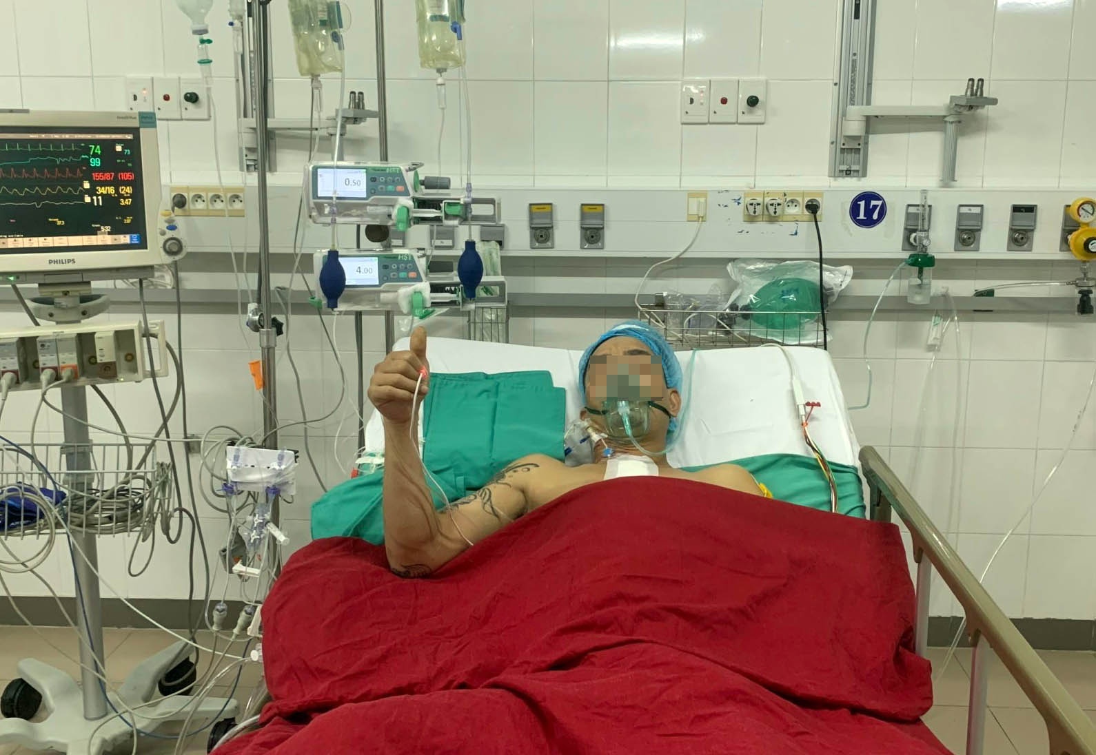 Ghep tim cho benh nhan anh 2