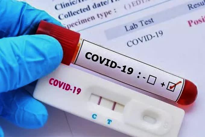 Hai nhan vien CDC Quang Tri mang kit test ban lai cho Cong ty Viet A hinh anh
