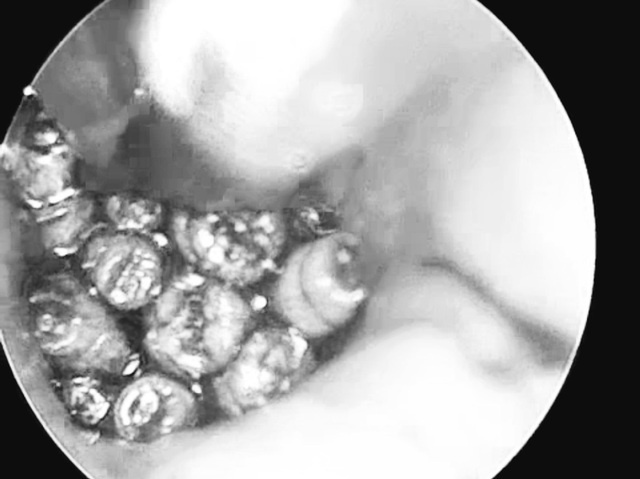 Hang chuc con gioi lam to trong tai nguoi dan ong hinh anh