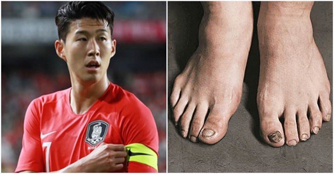 Ban chan Son Heung-min bam dap sau quang thoi gian cay ai lien tuc hinh anh