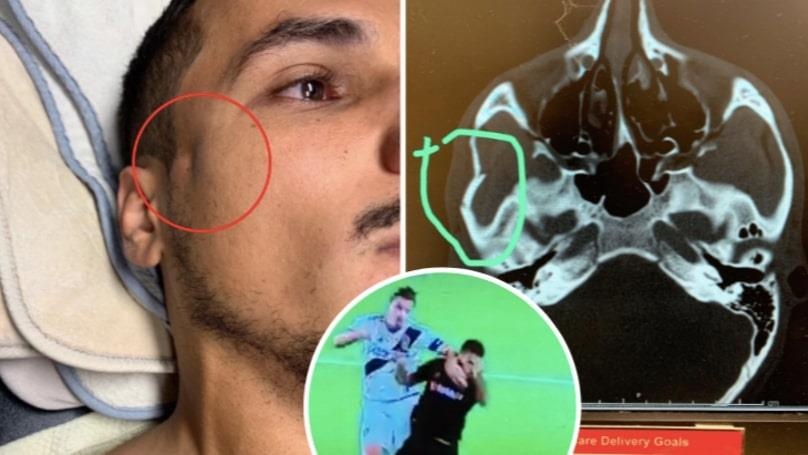 Zlatan Ibrahimovic anh 1