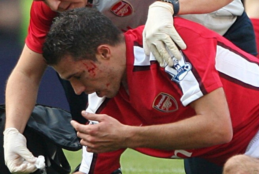 Arsenal ảnh 4 Arsenal anh 4