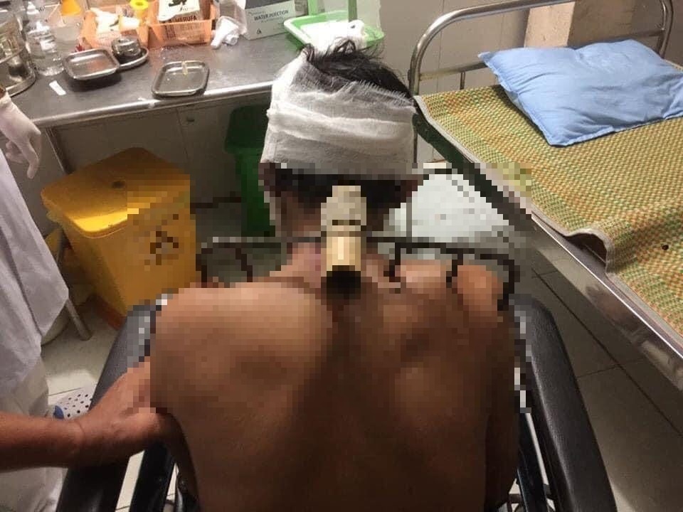 Chua co com an, con trai bo bo cao vao vai cha hinh anh