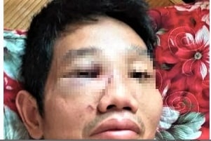 Can bo bi danh gay mui vi mau thuan tai chot kiem dich hinh anh