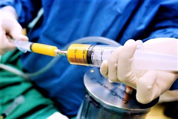 Khach tu vong khi nang nguc, chu phong kham bi xu ly the nao? hinh anh