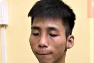 Nam thanh nien dau thu sau khi giet nguoi bang dao bau hinh anh