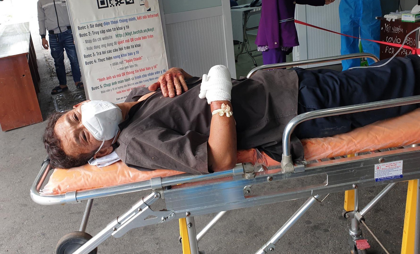 Lai xe chem lia ban tay nguoi dan doi dien muc an nao? hinh anh