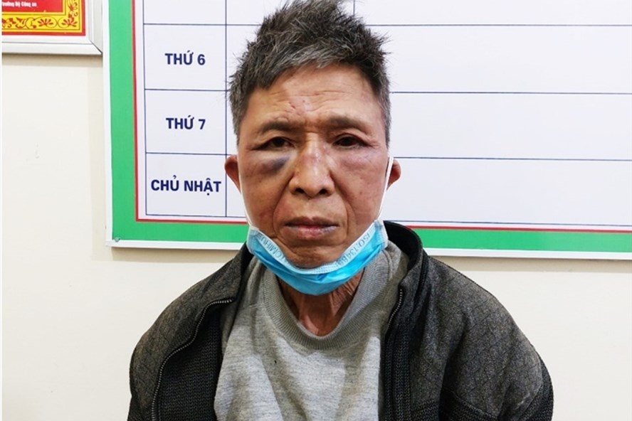 Tam giu ke tan cong 3 cong an bi thuong hinh anh