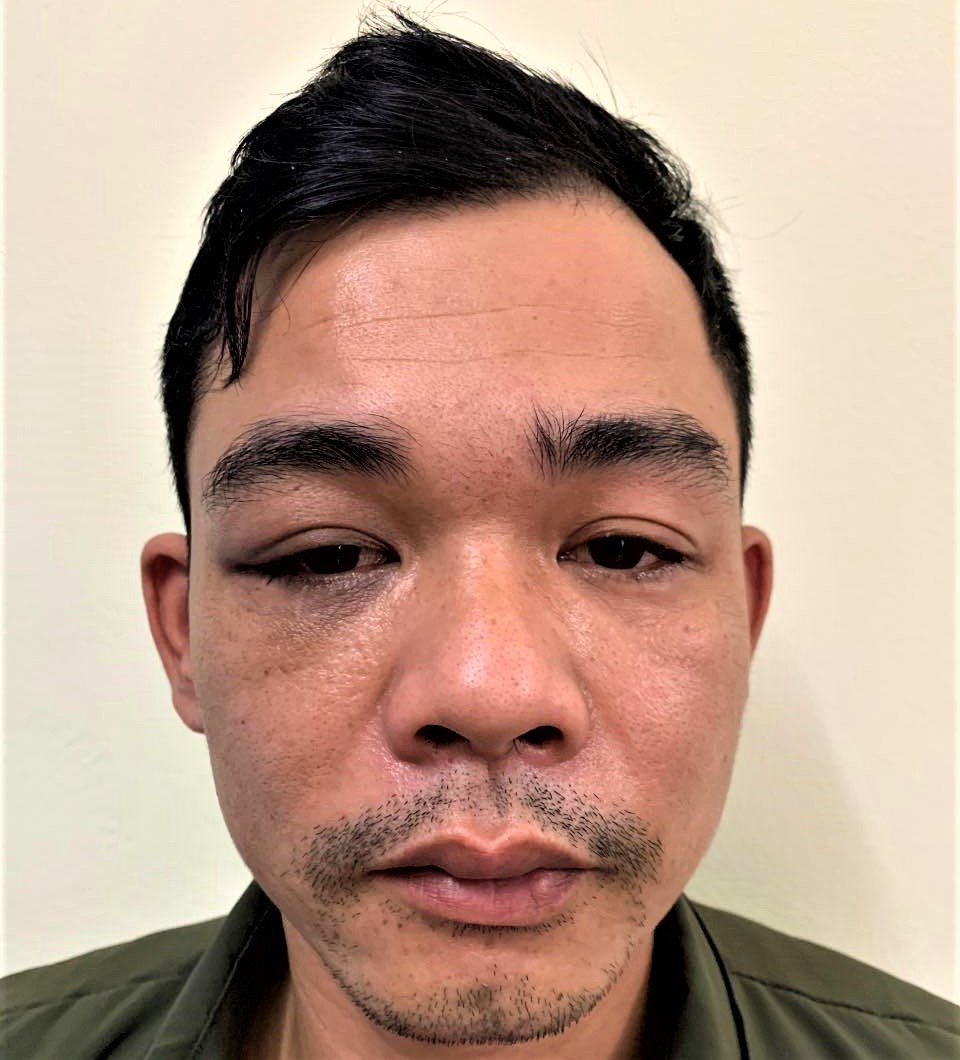 khách đánh thuốc ngủ chủ nhà ảnh 1 khach danh thuoc ngu chu nha anh 1