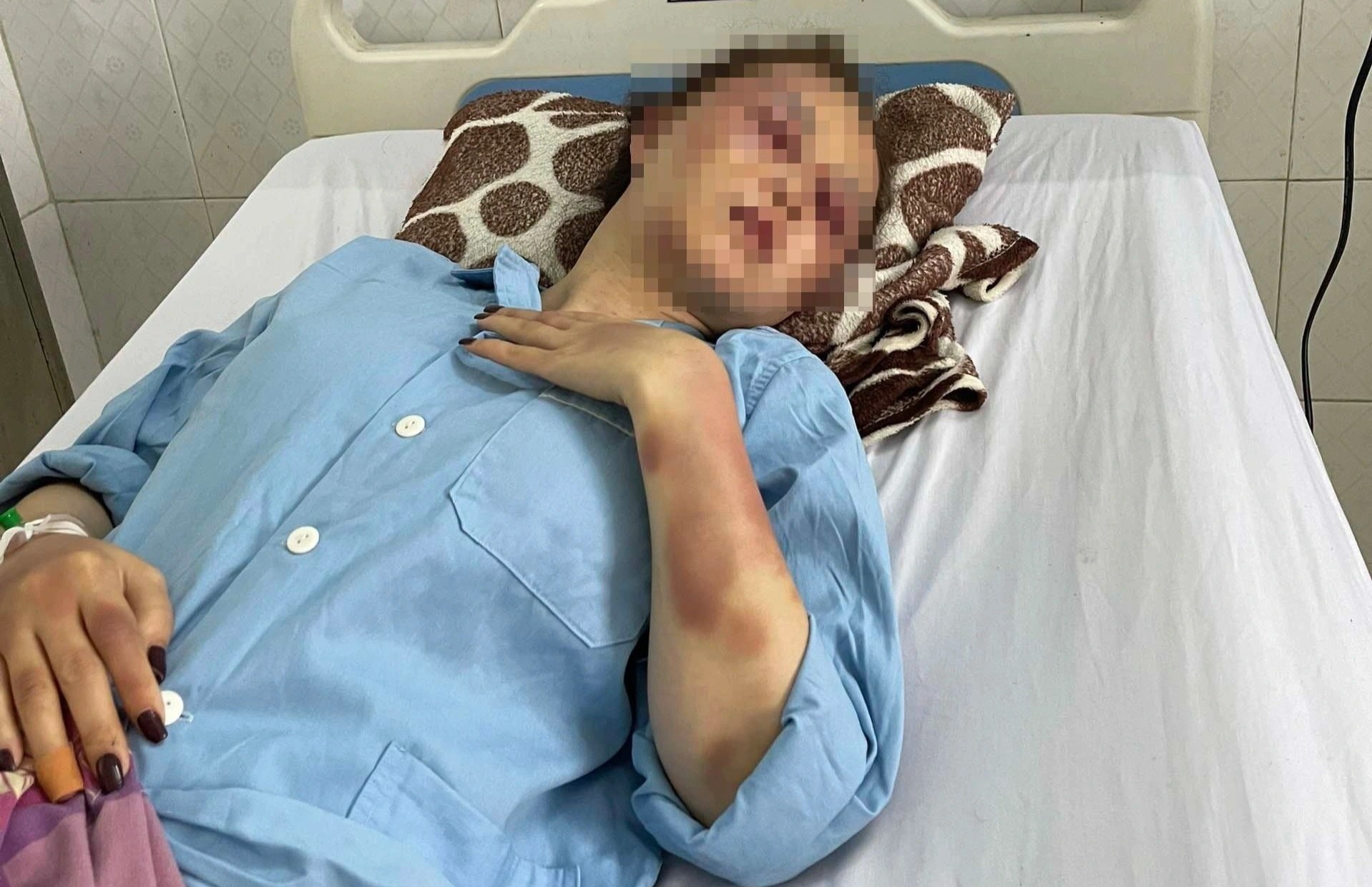 Vu danh nguoi tinh o quan karaoke: Hanh hung nan nhan nhu ke thu hinh anh