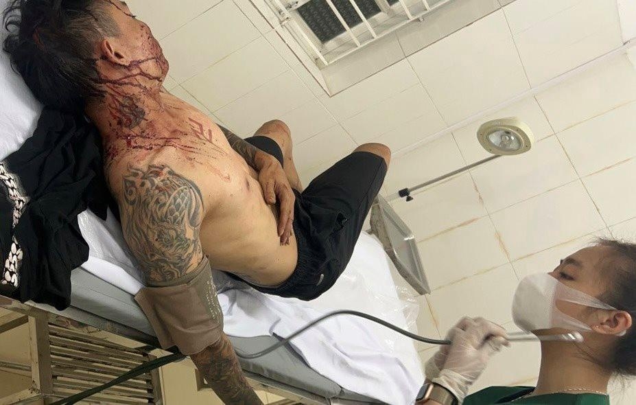 Bi danh trong thuong khi den gap nguoi vay no hinh anh