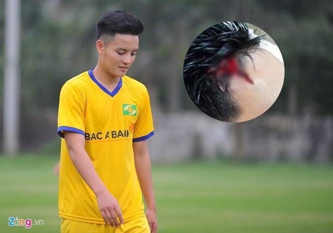 Va cham voi cau thu HAGL,  Van Khanh ngat lim tai san anh 2