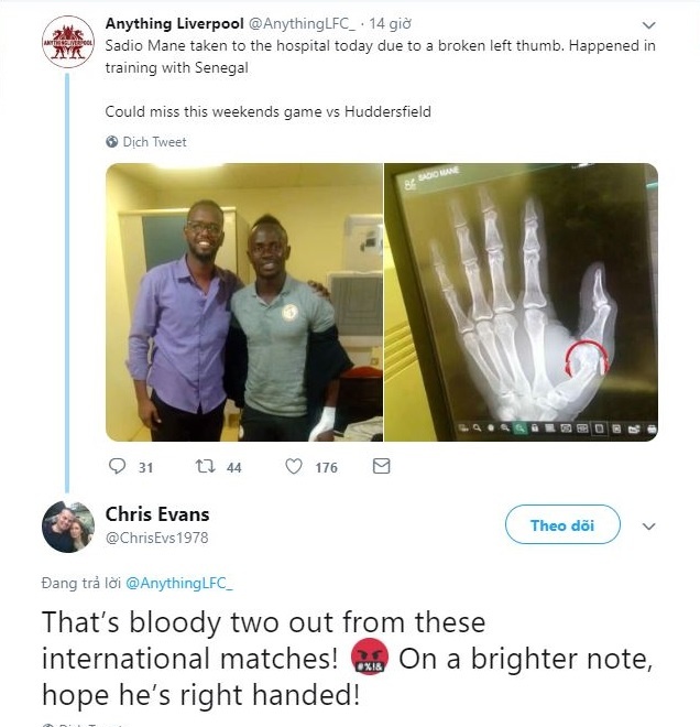 Mane gay ngon tay,  CDV Liverpool bat binh voi ‘virus FIFA’ anh 2