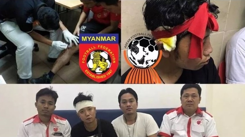 Myanmar buc xuc voi hanh vi con do cua CDV Malaysia hinh anh