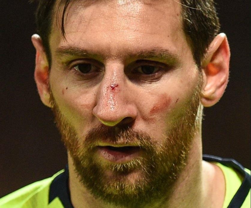 Messi do mau trong ngay Barca danh bai MU anh 1