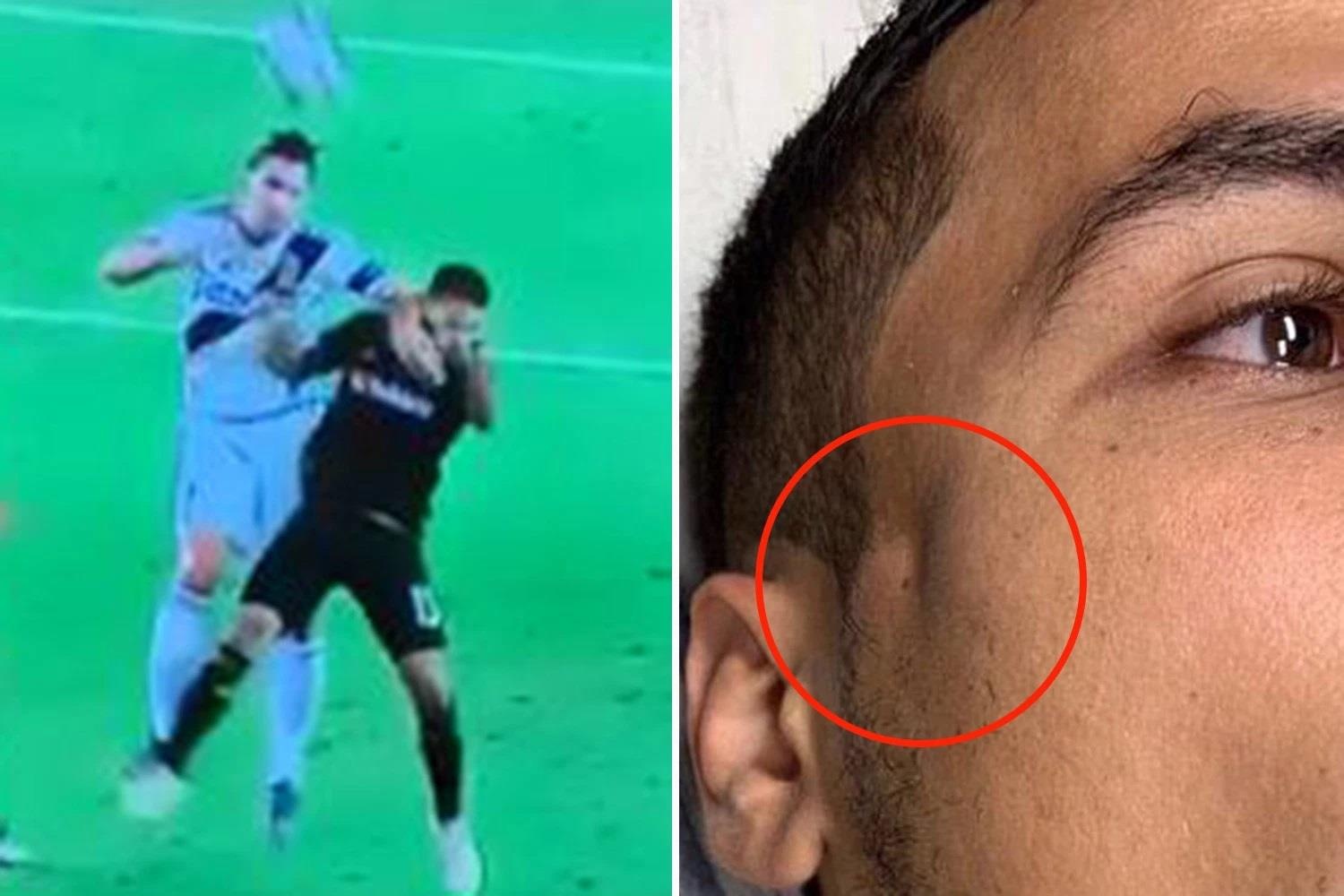 Ibrahimovic thúc chỏ đối thủ ảnh 1 Ibrahimovic thuc cho doi thu anh 1