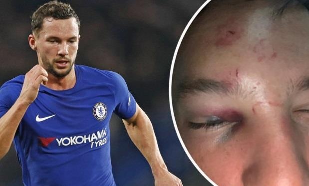 Sao Chelsea tra gia sau vu tan tinh ban gai dong nghiep hinh anh