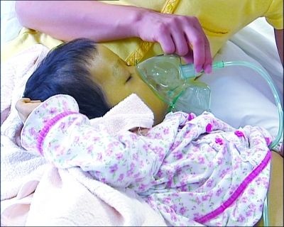 Be gai 4 tuoi co lan da mau xanh la cay hinh anh