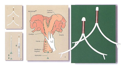 Dat vong cho... bo hinh anh