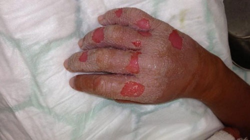 Bi bong nang vi vat chanh tuoi hinh anh