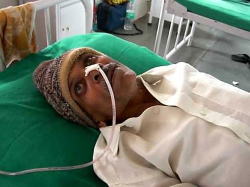 15 nguoi bi benh 'bo dien' vi dung cu mo hinh anh