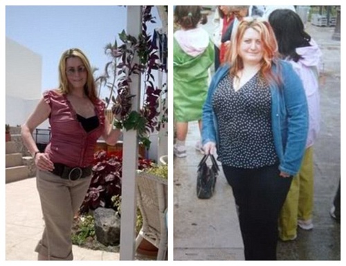 Ban nha lay tien phau thuat tham my de lay chong hinh anh