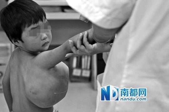 Be gai co khoi u to bang qua bong duoi nach hinh anh