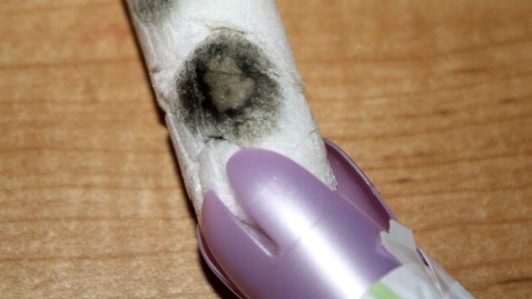 Thieu nu chet vi su dung bang ve sinh tampon hinh anh