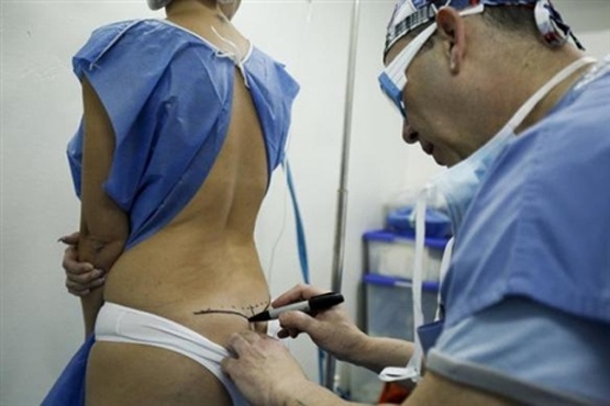 Chan sieu vong 3, phu nu Venezuela dua nhau cat bo silicon hinh anh