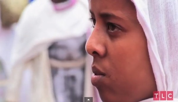 Co gai co 2 tay, 2 chan moc them o xuong chau hinh anh