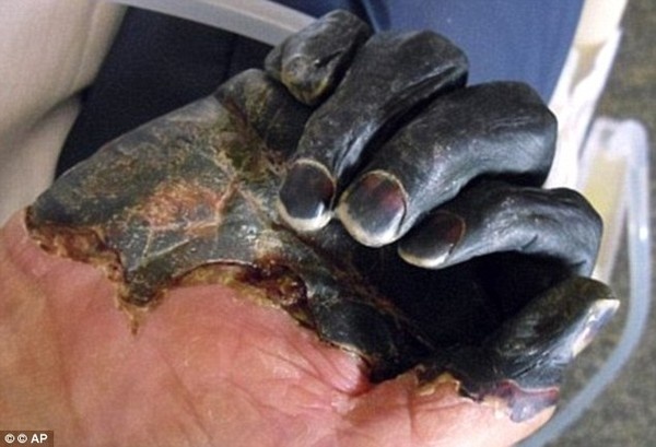 Tu chi chuyen sang mau den do meo can hinh anh