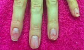 Cut mong vi dung son phu gia re hinh anh