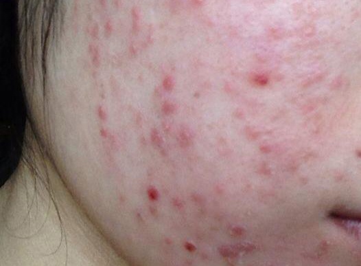 Tan pha dung nhan vi ham my pham 'xin' gia beo hinh anh