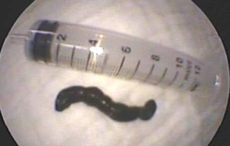 Trước đó, tối ngày 19/6/2014, sau khi mua gói bim bim 