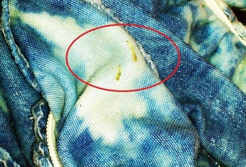 Chị gọi hàng xóm đến xem thì mỗi người một ý kiến khác nhau. Người cho rằng là đỉa con, người lại cho rằng là con lăng quăng. Sinh vật lạ ở Hải Phòng đến nay vẫn chưa được xác định là loài sinh vật nào và có nguy hại đến cộng đồng hay không.