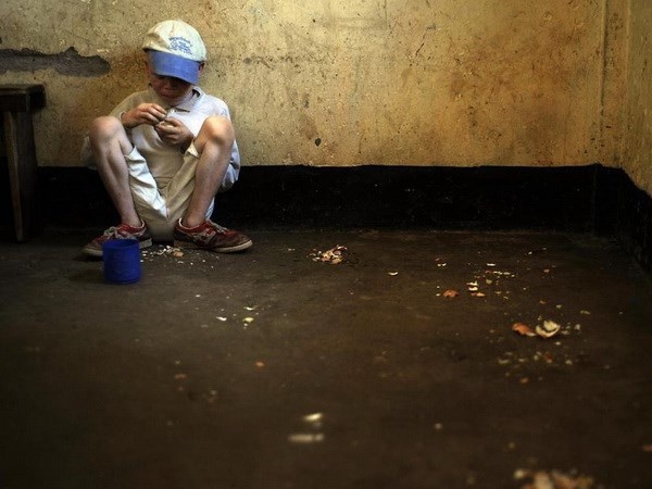 Một bé trai bị bệnh bạch tạng tại một trường học ở Mwanza, Tanzania. Ảnh chụp năm 2009.